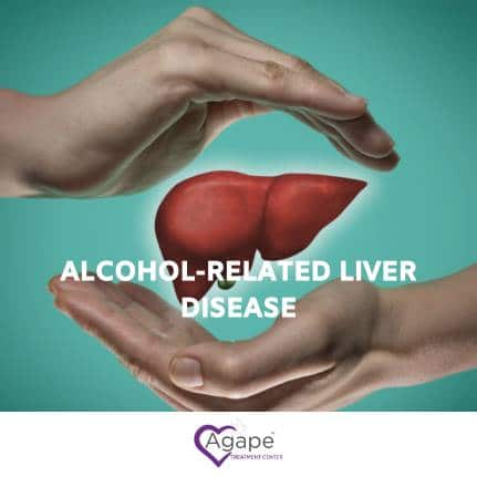 Alcohol-Related Liver Disease: Signs, Symptoms, & Treatment